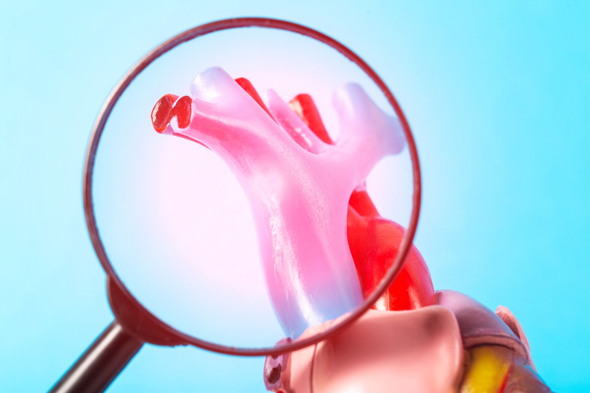 Grafika przedstawiająca przekrój żył człowieka pod lupą